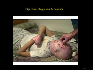Et je meurs chaque jour de douleurs… >>> 