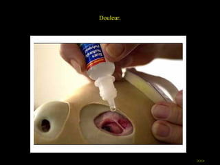 Douleur. >>> 