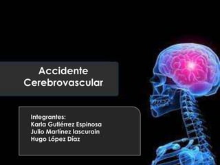 Accidente
Cerebrovascular
Integrantes:
Karla Gutiérrez Espinosa
Julio Martínez lascurain
Hugo López Díaz
 