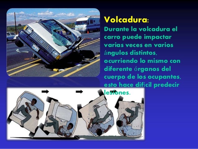 Accidente automovilistico
