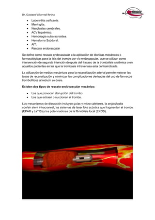 Dr. Gustavo Villarreal Reyna
 Laberintitis osificante.
 Meningitis.
 Neoplasias cerebrales.
 ACV Isquémico.
 Hemorragia subaracnoidea.
 Hematoma Subdural.
 AIT.
 Rescate endovascular
Se define como rescate endovascular a la aplicación de técnicas mecánicas o
farmacológicas para la lisis del trombo por vía endovascular, que se utilizan como
intervención de segunda intención después del fracaso de la trombolisis sistémica o en
aquellos pacientes en los que la trombosis intravenosa esta contraindicada.
La utilización de medios mecánicos para la recanalización arterial permite mejorar las
tasas de recanalización y minimizar las complicaciones derivadas del uso de fármacos
trombolíticos al reducir su dosis.
Existen dos tipos de rescate endovascular mecánico:
 Los que provocan disrupción del trombo.
 Los que extraen o succionan el trombo.
Los mecanismos de disrupción incluyen guías y micro catéteres, la angioplastia
con/sin stent intracraneal, los sistemas de laser foto acústica que fragmentan el trombo
(EPAR y LaTIS) y los potenciadores de la fibrinólisis local (EKOS).
 