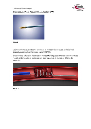 Dr. Gustavo Villarreal Reyna
Endovascular Photo Acoustin Recanalization EPAR
EKOS
Los mecanismos que extraen o succionan el trombo incluyen lazos, cestas o bien
dispositivos con guía en forma de espiral (MERCI).
El sistema de extracción mecánica de trombo MERCI puede utilizarse como medida de
rescate endovascular en pacientes con ictus isquémico de menos de 8 horas de
evolución.
MERCI
 