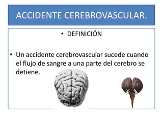 ACCIDENTE CEREBROVASCULAR.
• DEFINICIÓN
• Un accidente cerebrovascular sucede cuando
el flujo de sangre a una parte del cerebro se
detiene.
 