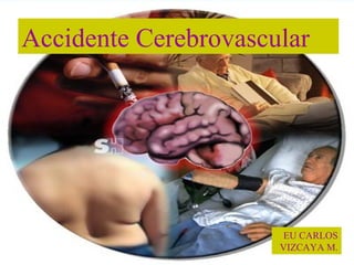 Accidente Cerebrovascular
EU CARLOS
VIZCAYA M.
 
