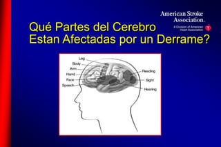 Qué Partes del Cerebro 
Estan Afectadas por un Derrame? 
 