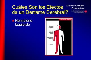 Cuáles Son los Efectos 
de un Derrame Cerebral? 
 Hemisferio 
Izquierdo 
 
