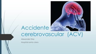 Accidente
cerebrovascular (ACV)
Alexander Díaz
Hospital santa clara
 