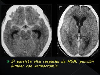    Si persiste alta sospecha de HSA: punción
    lumbar con xantocromía
 