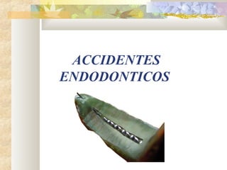 ACCIDENTES
ENDODONTICOS
 
