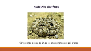 ACCIDENTE CROTÁLICO
 