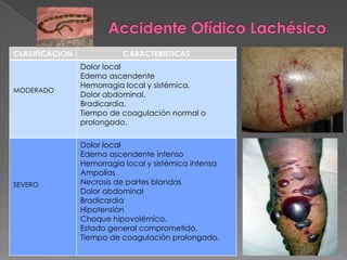 CLASIFICACION

MODERADO

SEVERO

CARACTERISTICAS
Dolor local
Edema ascendente
Hemorragia local y sistémica,
Dolor abdominal,
Bradicardia.
Tiempo de coagulación normal o
prolongado.
Dolor local
Edema ascendente intenso
Hemorragia local y sistémica intensa
Ampollas
Necrosis de partes blandas
Dolor abdominal
Bradicardia
Hipotensión
Choque hipovolémico,
Estado general comprometido.
Tiempo de coagulación prolongado.

 