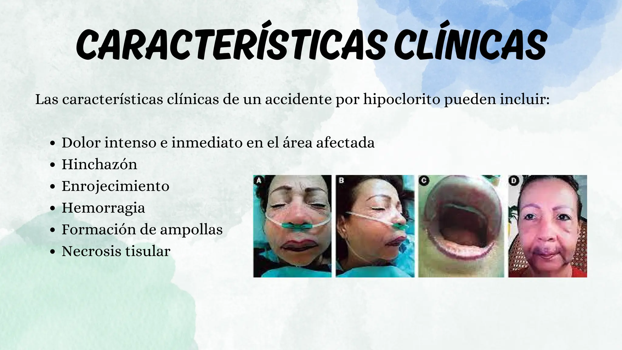 accidente-por-hipoclorito-mmnmnnmnmnmpdf-pdf