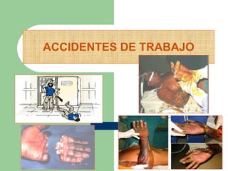 ACCIDENTES DE TRABAJO 