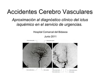 Accidentes Cerebro Vasculares
 Aproximación al diagnóstico clínico del ictus
   isquémico en el servicio de urgencias.
             Hospital Comarcal del Bidasoa
                      Junio 2011
 
