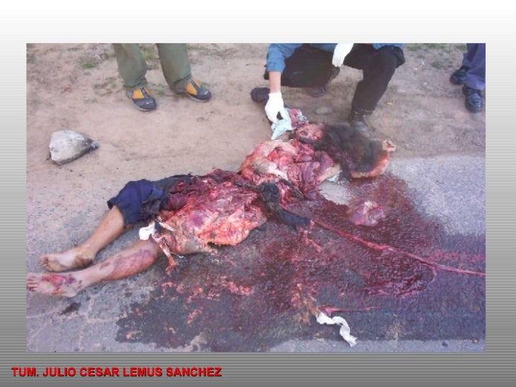 Imagenes Insolitas De Accidentes | videos de muertes horribles autos post Imagenes Insolitas De Accidentes | videos de muertes horribles autos post