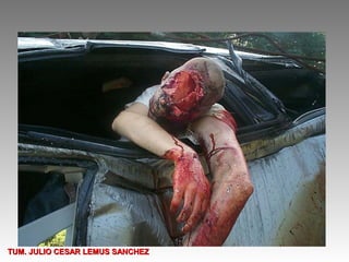 TUM. JULIO CESAR LEMUS SANCHEZ
 