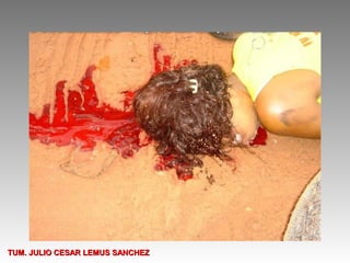 TUM. JULIO CESAR LEMUS SANCHEZ
 