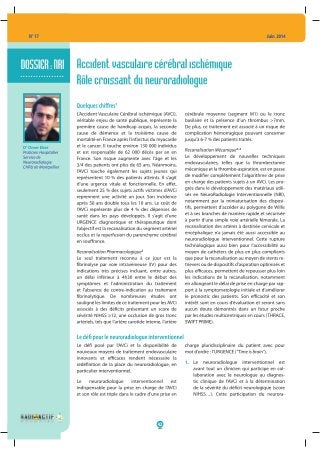 Accident vasculaire cérébral ischémique ; rôle croissant du neuroradiologue.