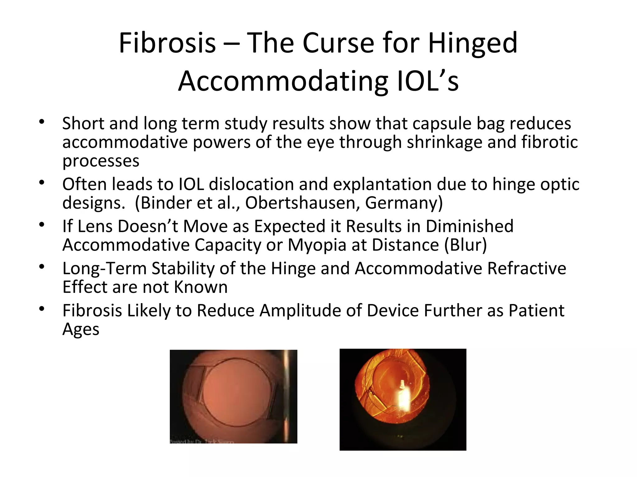 Fibrosis – The Curse for Hinged
               Accommodating IOL’s
• Short and long term study results show that capsule bag reduces
  accommodative powers of the eye through shrinkage and fibrotic
  processes
• Often leads to IOL dislocation and explantation due to hinge optic
  designs. (Binder et al., Obertshausen, Germany)
• If Lens Doesn’t Move as Expected it Results in Diminished
  Accommodative Capacity or Myopia at Distance (Blur)
• Long-Term Stability of the Hinge and Accommodative Refractive
  Effect are not Known
• Fibrosis Likely to Reduce Amplitude of Device Further as Patient
  Ages
 