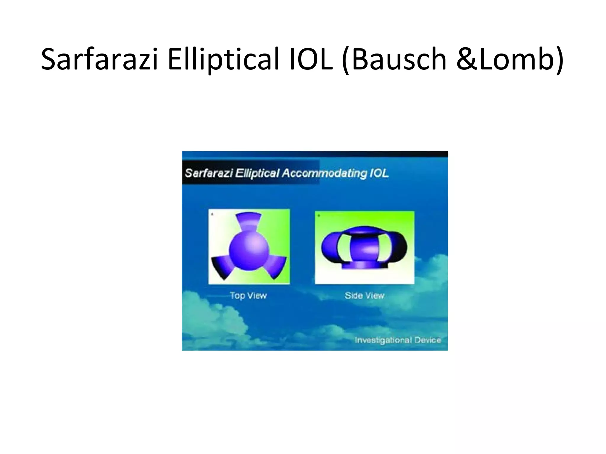 Sarfarazi Elliptical IOL (Bausch &Lomb)
 
