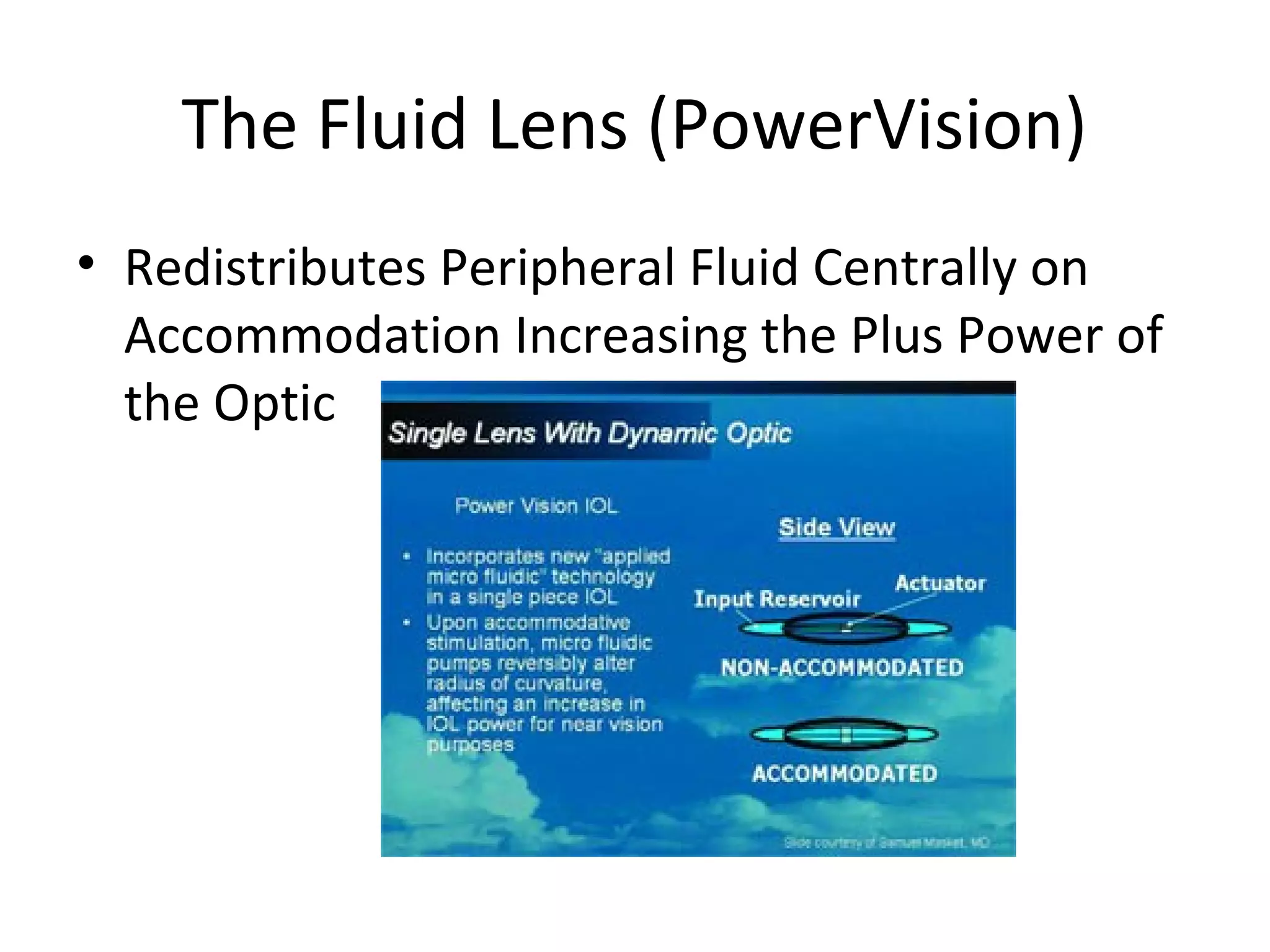 The Fluid Lens (PowerVision)
• Redistributes Peripheral Fluid Centrally on
  Accommodation Increasing the Plus Power of
  the Optic
 