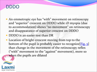 DDDO
 An emmetropic eye has “with” movement on retinoscopy
and “superior” crescent on DDDO while 1D myopia (due
to accomm...