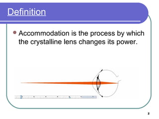 2
Accommodation is the process by which
the crystalline lens changes its power.
Definition
 