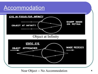 4
Accommodation
Near Object -- No Accommodation
Object at Infinity
 