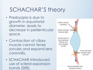 SCHACHAR’S theory
• Presbyopia is due to
growth in equatorial
diameter, leads to
decrease in perilenticular
space.
• Contraction of ciliary
muscle cannot tense
zonules and expand lens
coronally.

• SCHACHAR introduced
use of scleral expansion
bands (SEB).

 
