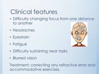Clinical features
• Difficulty changing focus from one distance
to another
• Headaches
• Eyestrain
• Fatigue
• Difficulty sustaining near tasks

• Blurred vision
Treatment: correcting any refractive error and
accommodative exercises.

 