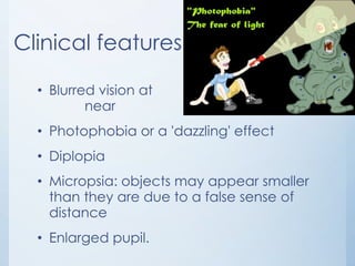 Clinical features
• Blurred vision at
near
• Photophobia or a 'dazzling' effect
• Diplopia
• Micropsia: objects may appear smaller
than they are due to a false sense of
distance
• Enlarged pupil.

 