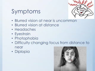 Symptoms
Blurred vision at near is uncommon
Blurred vision at distance
Headaches
Eyestrain
Photophobia
Difficulty changing focus from distance to
near
• Diplopia
•
•
•
•
•
•

 