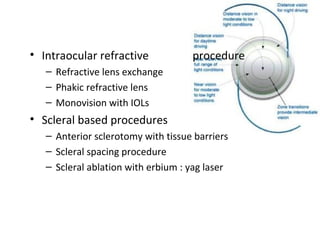 • Intraocular refractive procedure
– Refractive lens exchange
– Phakic refractive lens
– Monovision with IOLs
• Scleral based procedures
– Anterior sclerotomy with tissue barriers
– Scleral spacing procedure
– Scleral ablation with erbium : yag laser
 