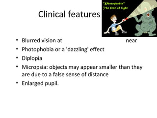 Clinical features
• Blurred vision at near
• Photophobia or a 'dazzling' effect
• Diplopia
• Micropsia: objects may appear smaller than they
are due to a false sense of distance
• Enlarged pupil.
 