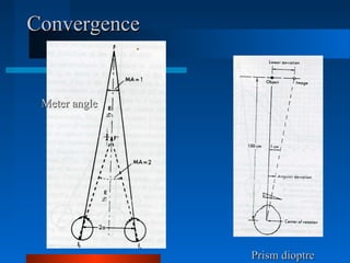 ConvergenceConvergence
Prism dioptrePrism dioptre
Meter angleMeter angle
 