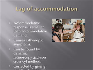  Accommodative
response is smaller
than accommodative
demand.
 Causes asthenopic
symptoms.
 Can be found by
dynamic
retinoscopy ,jackson
cross cyl method.
 Corrected by giving
 
