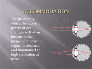  The process by
which the dioptric
power of eye
changes so that an
infocus retinal
image of an object of
regard is obtained
and maintained at
high resolution at
fovea.
 