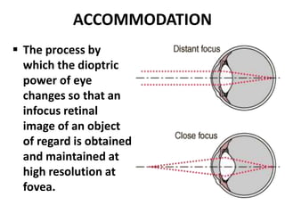 Accommodative anomalies (Full) | PPTX
