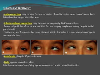 SUBSEQUENT TREATMENT:
-undercorrection: may require furthur recession of medial rectus ,resection of one or both
lateral recti or surgery to other eye.
-inferior oblique overaction: may develop subsequently. M/C around 2yrs.
Parents shpuld therefore be warned that furthur surgery maybe necessary despite initial
good result.
Unilateral, and frequently becomes bilateral within 6months. It is over-elevation of eye in
supra-adduction.
-Amblyopia: devp in 50percent cases.
-DVD: appear several yrs after.
It is the elevation of non-fixing eye when covered or with visual inattention.
 