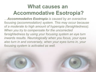 What causes an
Accommodative Esotropia?
…Accommodative Esotropia is caused by an overactive
focusing (accommodation) system. This may occur because
of a moderate to high amount of hyperopia (farsightedness).
When you try to compensate for the uncorrected
farsightedness by using your focusing system an eye turn
inwards results. Neurologically when you focus, your eyes
also turn in and conversely, when your eyes turns in, your
focusing system is activated as well.

 