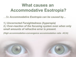 What causes an
Accommodative Esotropia?
…So Accommodative Esotropia can be caused by…
1.) Uncorrected Farsightedness (hyperopia)
2.) Over-reaction of the focusing system even when only
small amounts of refractive error is present.
(High accommodation-convergence accommodation ratio AC/A)

 