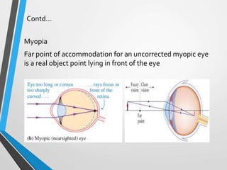 Contd…
Myopia
Far point of accommodation for an uncorrected myopic eye
is a real object point lying in front of the eye
 