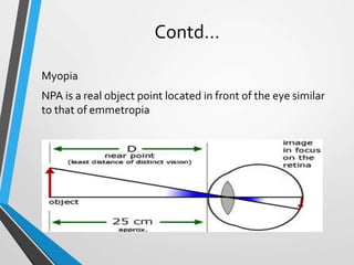 Contd…
Myopia
NPA is a real object point located in front of the eye similar
to that of emmetropia
 