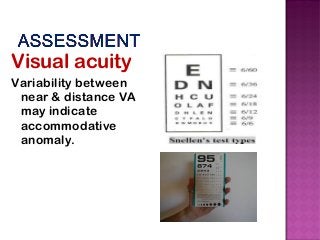 Visual acuity
Variability between
near & distance VA
may indicate
accommodative
anomaly.
 