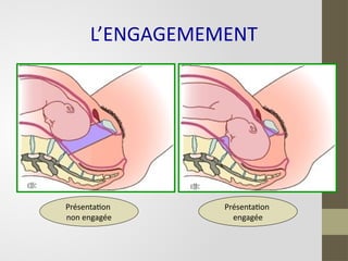 Présentation
non engagée
Présentation
engagée
L’ENGAGEMEMENT
 