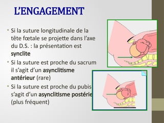 L’ENGAGEMENT
• Si la suture longitudinale de la
tête fœtale se projette dans l’axe
du D.S. : la présentation est
synclite
• Si la suture est proche du sacrum
il s’agit d’un asynclitisme
antérieur (rare)
• Si la suture est proche du pubis il
s’agit d’un asynclitisme postérieur
(plus fréquent)
 