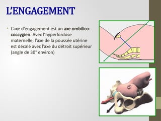 L’ENGAGEMENT
• L’axe d’engagement est un axe ombilico-
coccygien. Avec l’hyperlordose
maternelle, l’axe de la poussée utérine
est décalé avec l’axe du détroit supérieur
(angle de 30° environ)
 