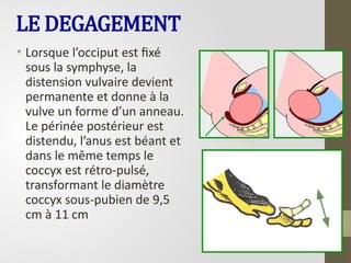 LE DEGAGEMENT
• Lorsque l’occiput est fixé
sous la symphyse, la
distension vulvaire devient
permanente et donne à la
vulve un forme d’un anneau.
Le périnée postérieur est
distendu, l’anus est béant et
dans le même temps le
coccyx est rétro-pulsé,
transformant le diamètre
coccyx sous-pubien de 9,5
cm à 11 cm
 