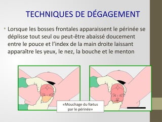 • Lorsque les bosses frontales apparaissent le périnée se
déplisse tout seul ou peut-être abaissé doucement
entre le pouce et l’index de la main droite laissant
apparaître les yeux, le nez, la bouche et le menton
«Mouchage du fœtus
par le périnée»
TECHNIQUES DE DÉGAGEMENT
 