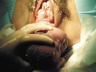 83
F.M.C. S.A.M.U. 83
 